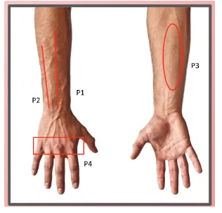Pain to Recovery: A Desk Worker's Journey — 8-Week Wrist Pain Case Study